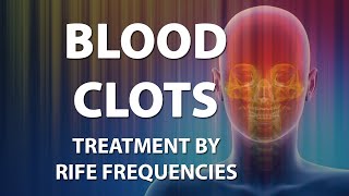 Blood Clots Hypercoagulability  Thrombus  RIFE Frequencies  Quantum Medicine with Bioresonance [upl. by Aiym]