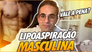 ANÁLISE E RESULTADO DA LIPO MASCULINA O QUE ESPERAR DO PROCEDIMENTO [upl. by Levin]