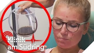 Gegen Pickel Mädchen gießt sich Kaffee ins Poloch  Klinik am Südring  SAT1 TV [upl. by Anaujait]