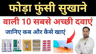 Foda funsi sukhane ki tablet  फोड़ा फुंसी की दवा Antibiotics For Boils  Baltod treatment at home [upl. by Oca932]