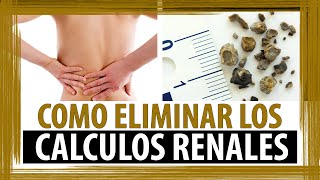 TRATAMIENTO NATURAL PARA PIEDRAS EN EL RIÑON  COMO ELIMINAR LOS CALCULOS RENALES [upl. by Etnuhs425]