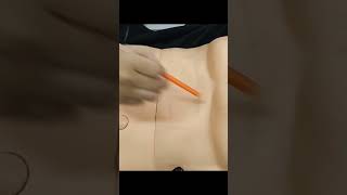 abdominal assessment [upl. by Sara]