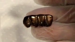 can this extreme tarnish 10k gold grill be cleaned how to stop it from getting tarnished [upl. by Barna]