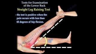 Tests For Examination Of The Lower Back  Everything You Need To Know  Dr Nabil Ebraheim [upl. by Yor]