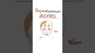 Propionibacterium acnes  Acne Vulgaris  Microbiology science microbiology nurse doctor mbbs [upl. by Ideih]