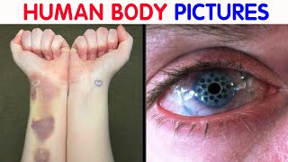 “My Eye Is Gradually Losing Its Color” 50 Interesting Human Body Pics [upl. by Rickert]