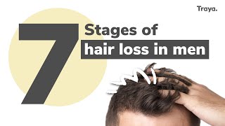 7 Stages of Hair Loss in Men  Right Time to Start the Treatment  Hair Regrowth  Traya Health [upl. by Elamaj799]