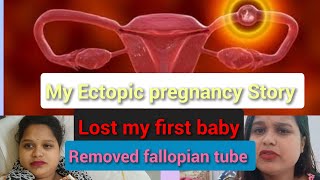 My Ectopic pregnancy story  Lost my first baby meri death bhi ho skti thi  Emergency operation [upl. by Ecnal164]