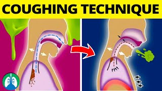 This COUGHING Technique Can Help Get Rid of Mucus and Phlegm ❗ [upl. by Eibob]