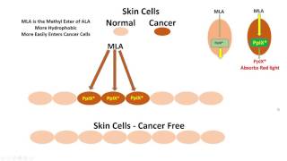 Photodynamic Therapy Heme Metabolism Porphyria Cutanea Tarda and Vampires [upl. by Holbrooke]