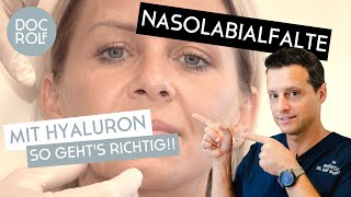 NASOLABIALFALTEN MIT HYALURON ERKLÄRT von Dr Rolf Bartsch [upl. by Daj]