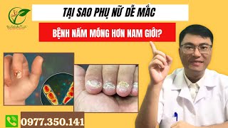 Tại Sao Phụ Nữ Dễ Mắc Bệnh Nấm Móng Hơn Nam Giới [upl. by Bowler]