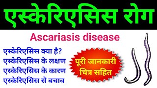 एस्केरिएसिस क्या है  ascariasis class 12  ascariasis microbiology  ascariasis disease in hindi [upl. by Hennessy]