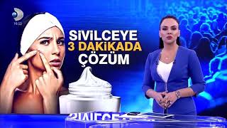 Sivilceye karşı 3 dakikada kesin cözüm [upl. by Shiverick]