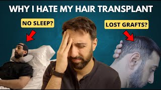 10 things I HATE about my Hair Transplant and how I dealt with it [upl. by Lewap593]