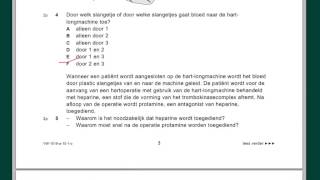 VWO biologie Examenuitleg 2010 tijdvak 1 vr 15 en 2835 deel 1 [upl. by Schmitt147]