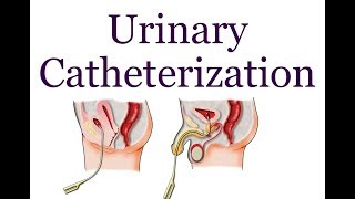 Urinary Catheterization  Hindi [upl. by Hselin236]