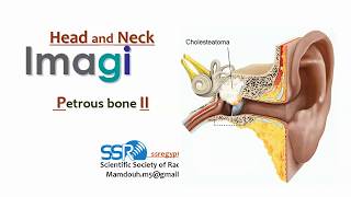 6 Petrous Bone  part 2  profMamdouh Mahfouz 2019 edition [upl. by Saixela]