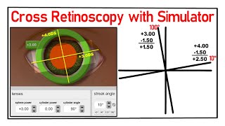 Cross Retinoscopy with Simulator How practice with Simulator [upl. by Ut]