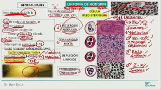 Hematología  Linfoma de hodgkin linfoma no hosgkin mieloma multiple sindrome de lisis tumoral [upl. by Noissap]