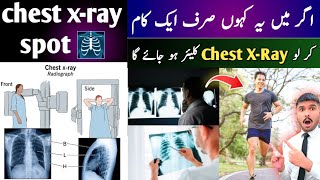 chest xray clear kaise kare 🩻 sirf ek kam kar lo chest xray clear ho jaega ✅️ [upl. by Waddington]