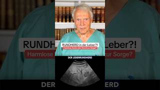 Rundherd in der LEBER 🩺🚨  Harmlose Zyste oder Grund zur Sorge… fy leber liver gesundheit [upl. by Aneez]