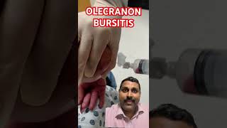 OLECRANON BURSITIS [upl. by Akem]