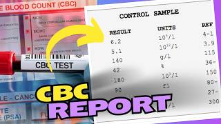 CBC Blood Test Results How to Read and Understand Your Results [upl. by Melany]