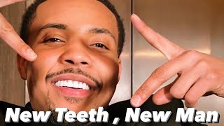 G herbo Fixed His Teeth After Fans Negative Comments 😨 [upl. by Ynaffet420]