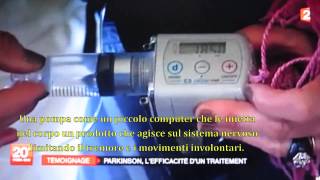 Morbo di Parkinson  Infusioni sottocutanee di Apomorfina [upl. by Dene]