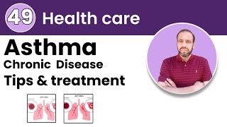 Asthma Understanding the Condition and Managing Its Symptoms [upl. by Coray]