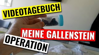 Videotagebuch zur Operation meiner Gallensteine [upl. by Stevy]