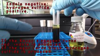 SIM Medium Detection of Indole and Hydrogen Sulfide Production [upl. by Asseneg499]