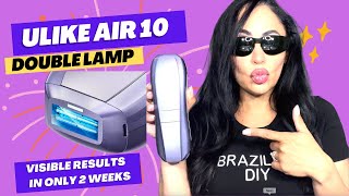 ULIKE AIR 10 LASER HAIR REMOVAL AT HOME  UNBOXING amp REVIEW  10MONTHS WITHOUT SHAVING [upl. by Ambert]