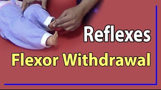 01 Flexor Withdrawal Reflex [upl. by Olrac]